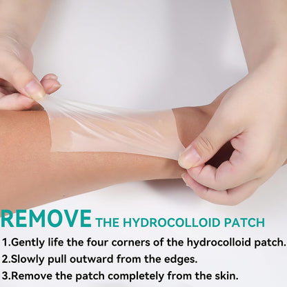 Upadated Hydrocolloid Bandages,2in*5ft Hydrocolloid Roll for Wound Care,Medical-Grade Hydrocolloid Patch Bandages with Self-Adhesive, Flexible & Waterproof DIY Size & Shape (2in*5ft)