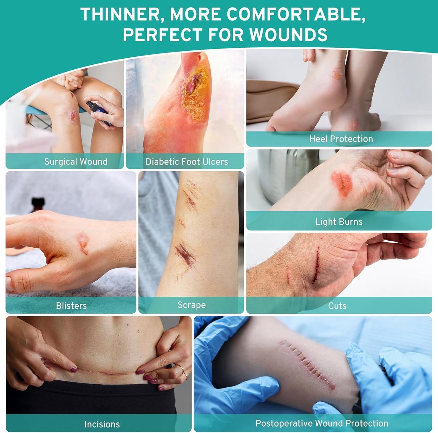 Upadated Hydrocolloid Bandages,2in*5ft Hydrocolloid Roll for Wound Care,Medical-Grade Hydrocolloid Patch Bandages with Self-Adhesive, Flexible & Waterproof DIY Size & Shape (2in*5ft)